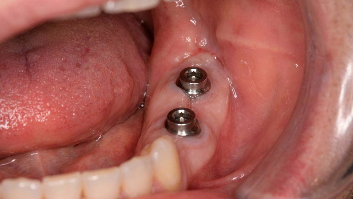 Что видно на КТ