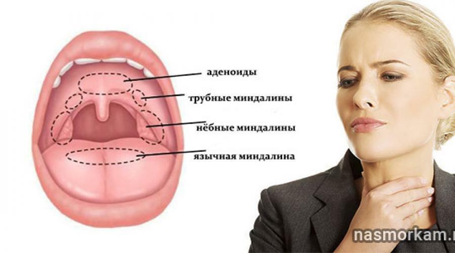 Боль в горле: топ-5 способов помочь себе