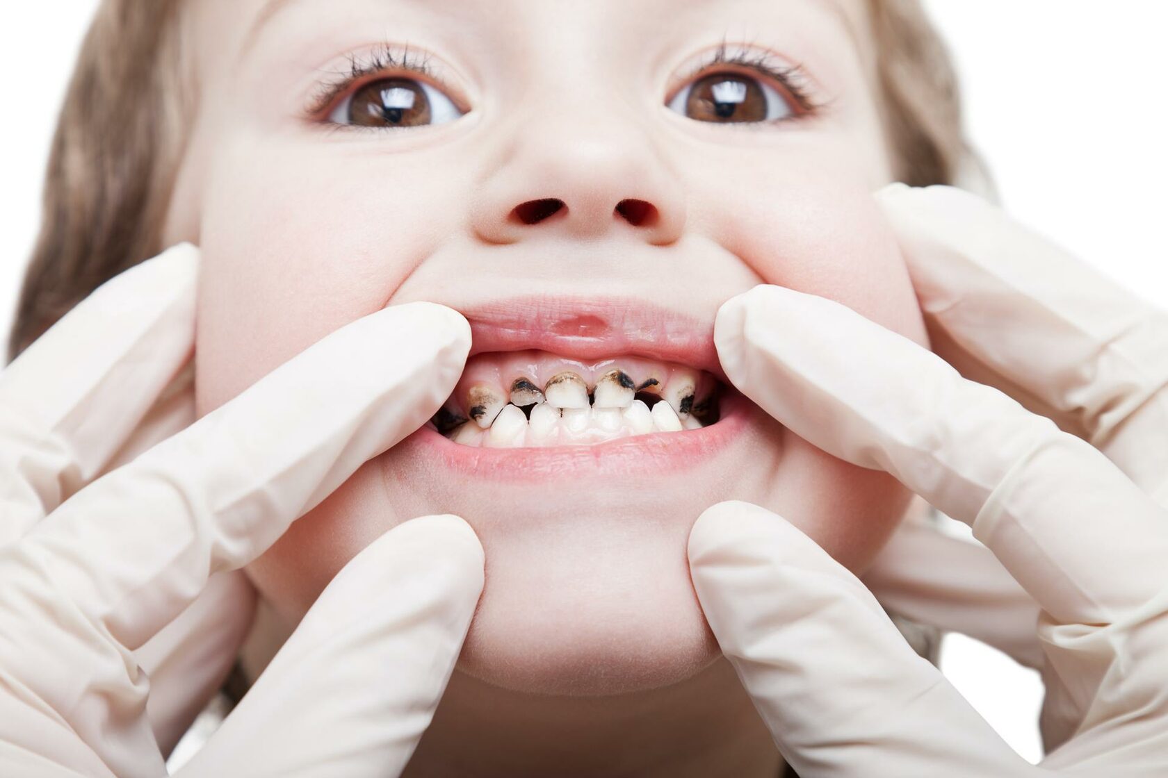 Чувствительность зубов: причины, лечение, как снизить