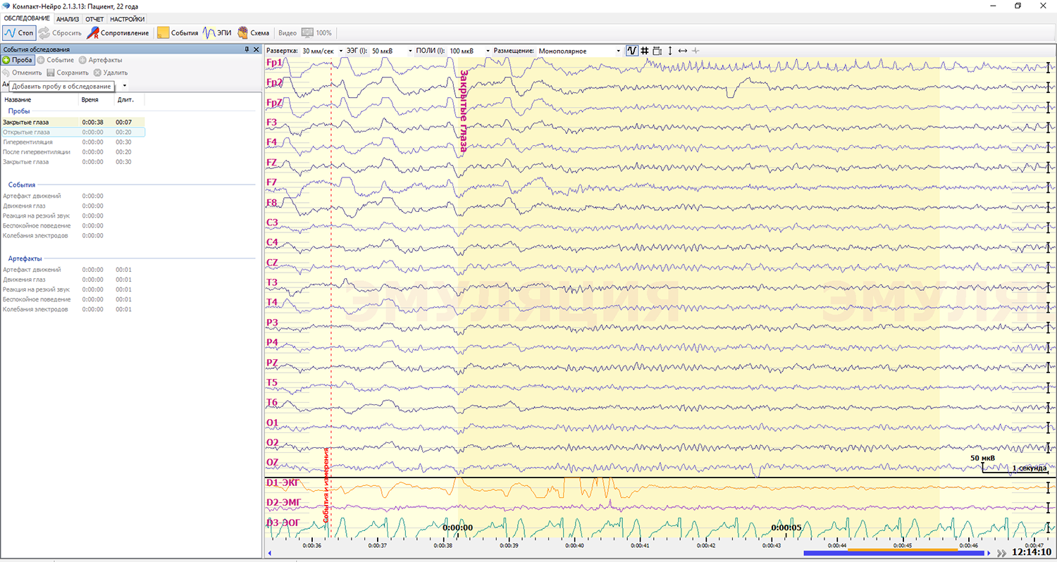 Как удалить историю нейро. Компакт-Нейро 16-канальный. Компакт Нейро ЭЭГ. Система электроэнцефалографическая (компакт-Нейро). Система электроэнцефалографическая «компакт-Нейро» 21 канал.