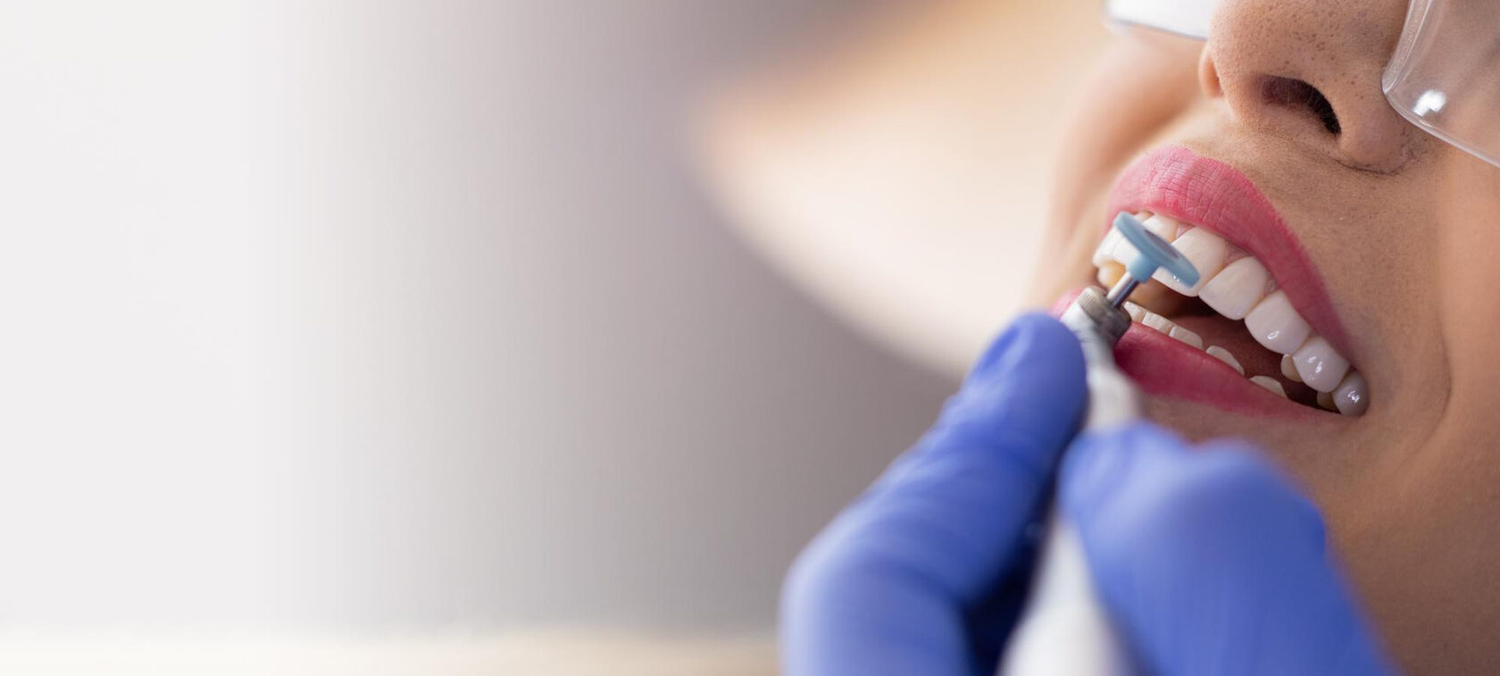 Профгигиена зубов