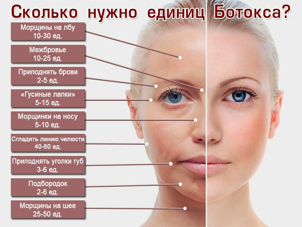 Ботулинотерапия лица в Москве — Цена в центре косметологии «Cosmetologbest»
