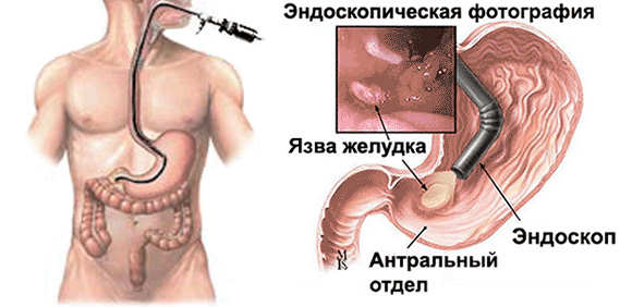 Эндоскопия смешные картинки