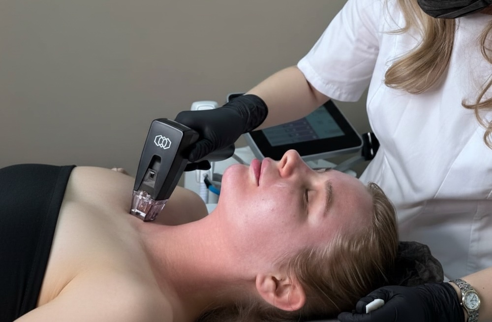 рф лифтинг морфеус 8 для укрепления кожи на шее