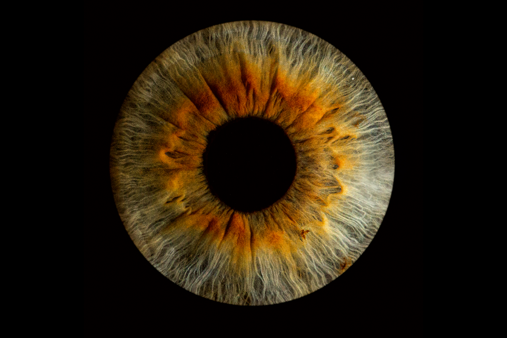 Болотные глаза: Чем определяется болотный цвет глаз?