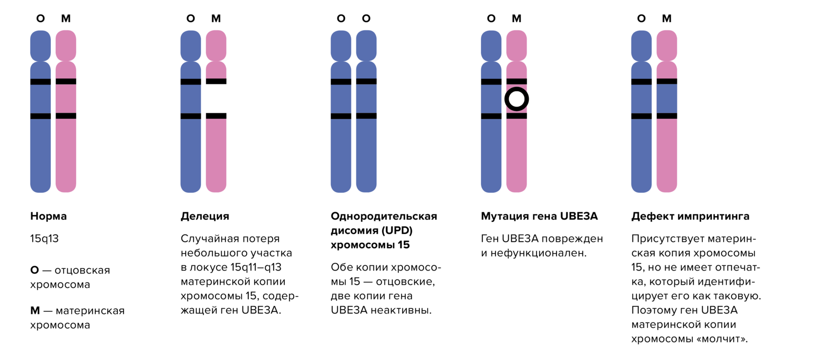 5 хромосома синдром. Синдром Ангельмана хромосомы. Делеция длинного плеча 18 хромосомы. Линейное расположение генов в хромосоме.