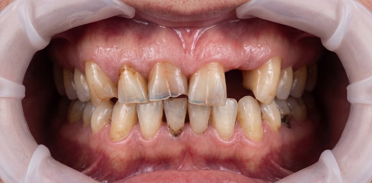 До лечения, случай 3