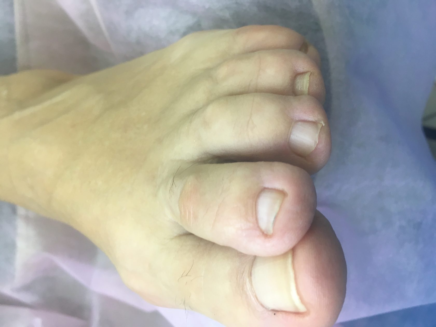 Изготовление ортозов в Курске