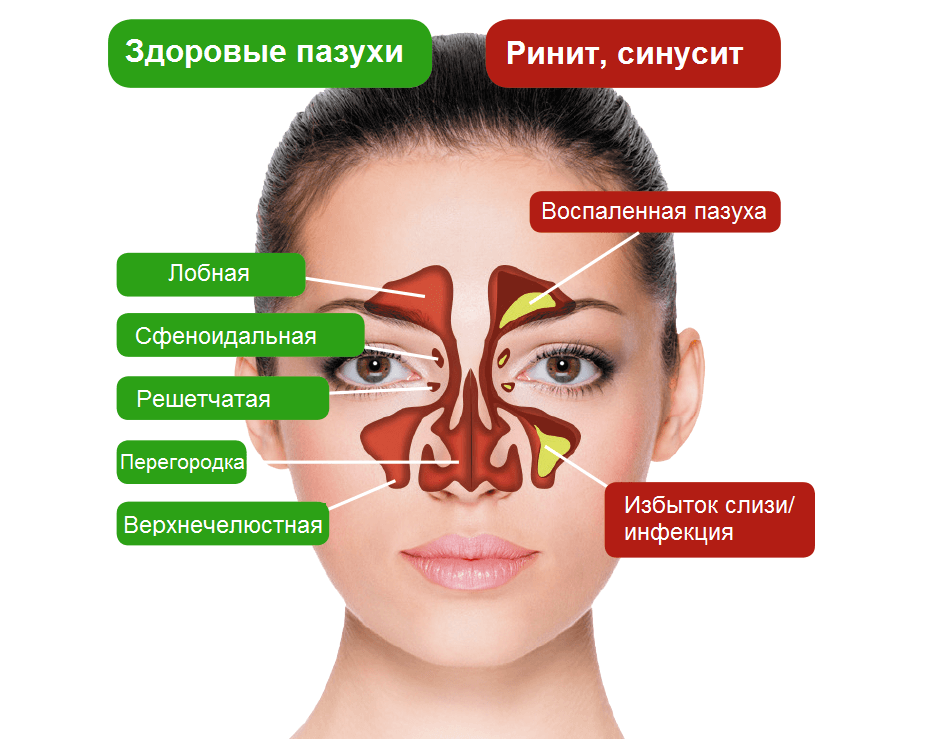 Схема гайморовых пазух на лице