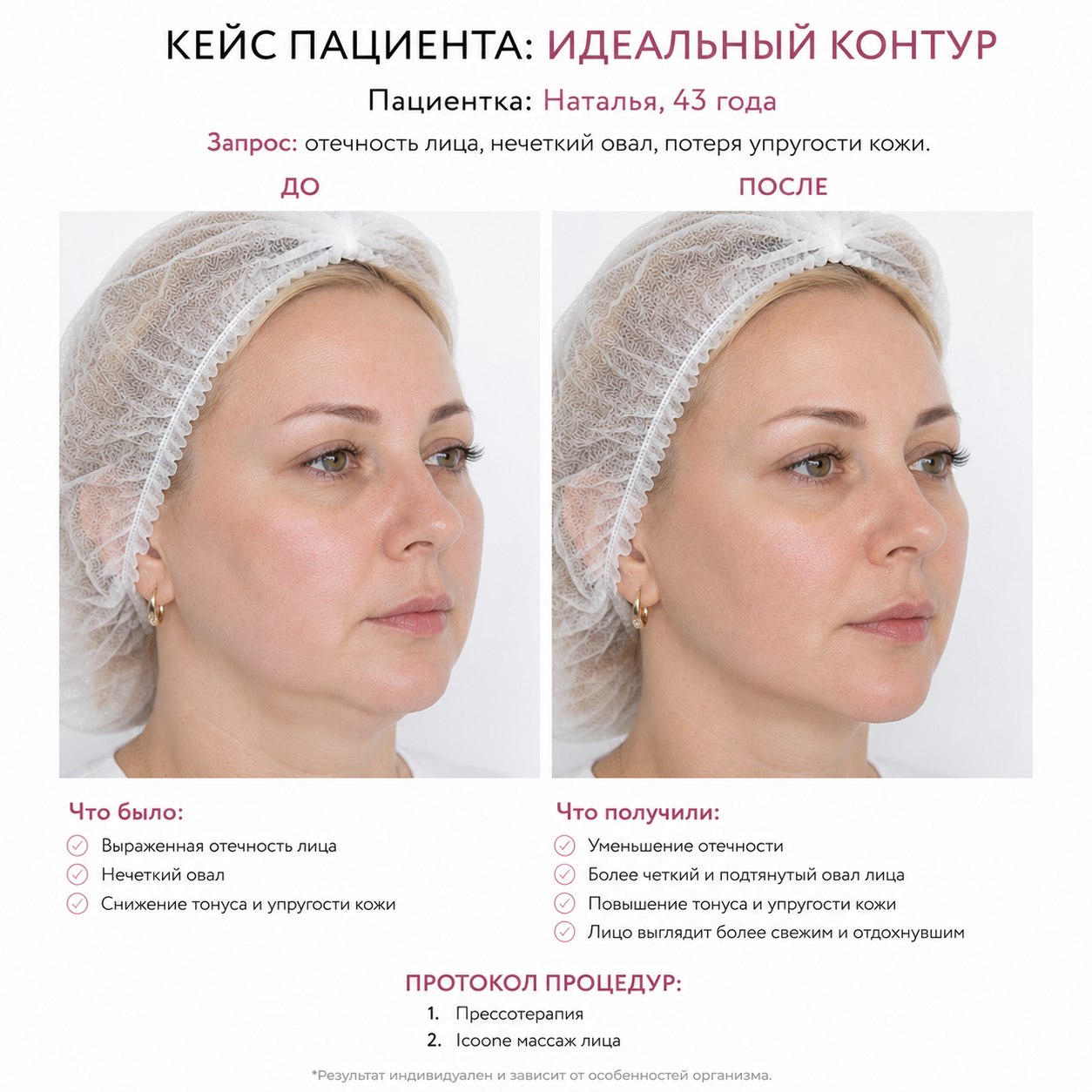 Кейс пациента до и после