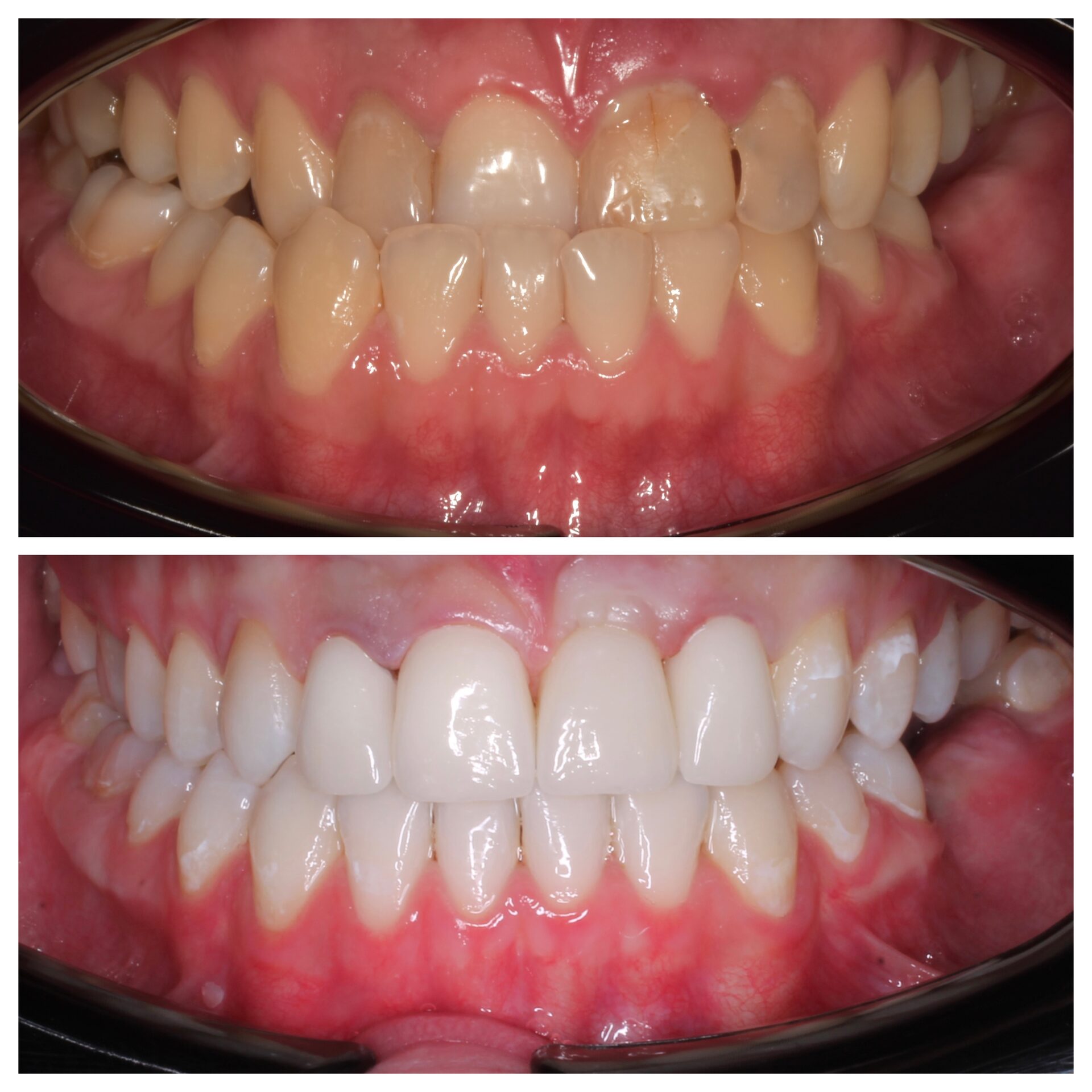 брекеты чебоксары,виниры чебоксары,имплантация зубов чебоксары