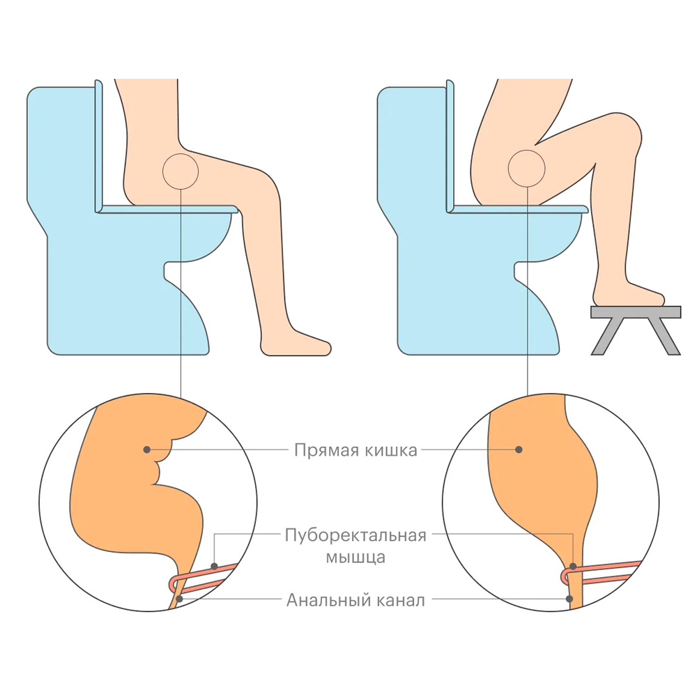 отсутствие стула после операции на кишечнике