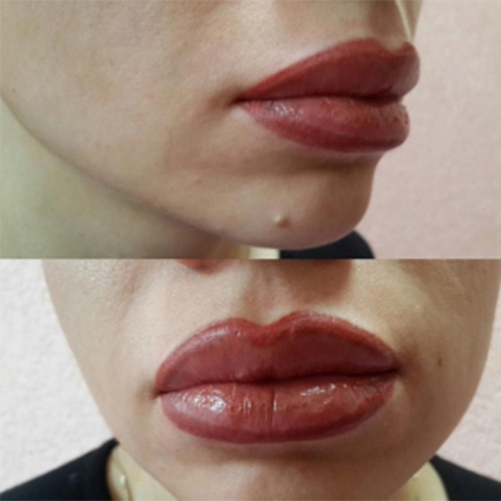 Неудачный перманентный макияж губ: фото, как избежать плохого татуажа