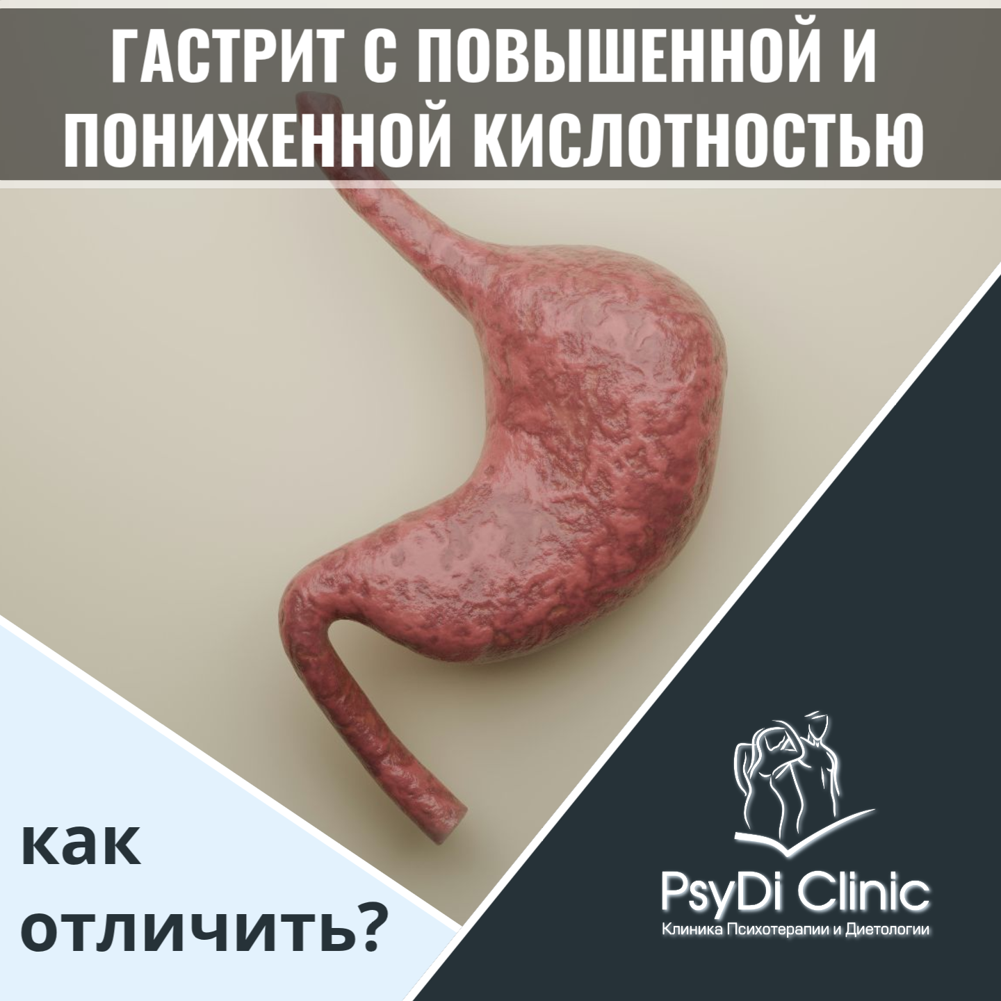 Гастрит с повышенной и пониженной кислотностью: как отличить?