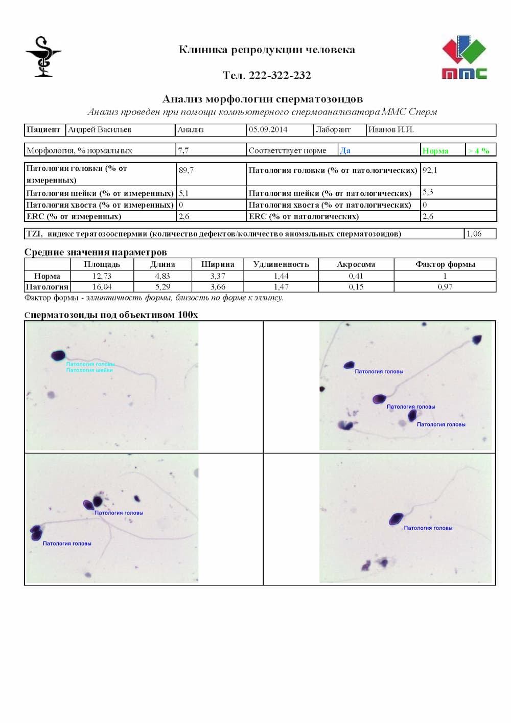 ММС Сперм (MMC Sperm) - автоматизированное программное обеспечение для  анализа качества спермы