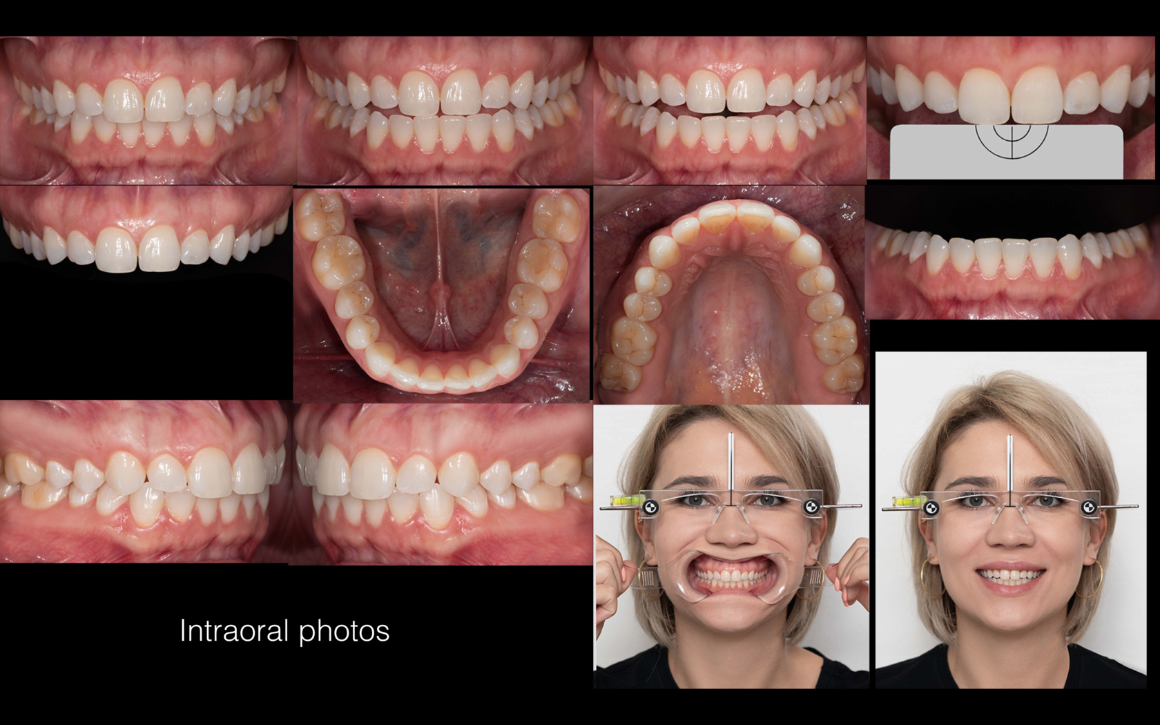 Дентальная фотография презентация