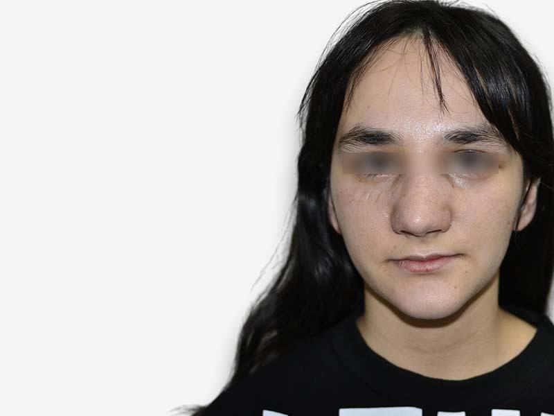 После