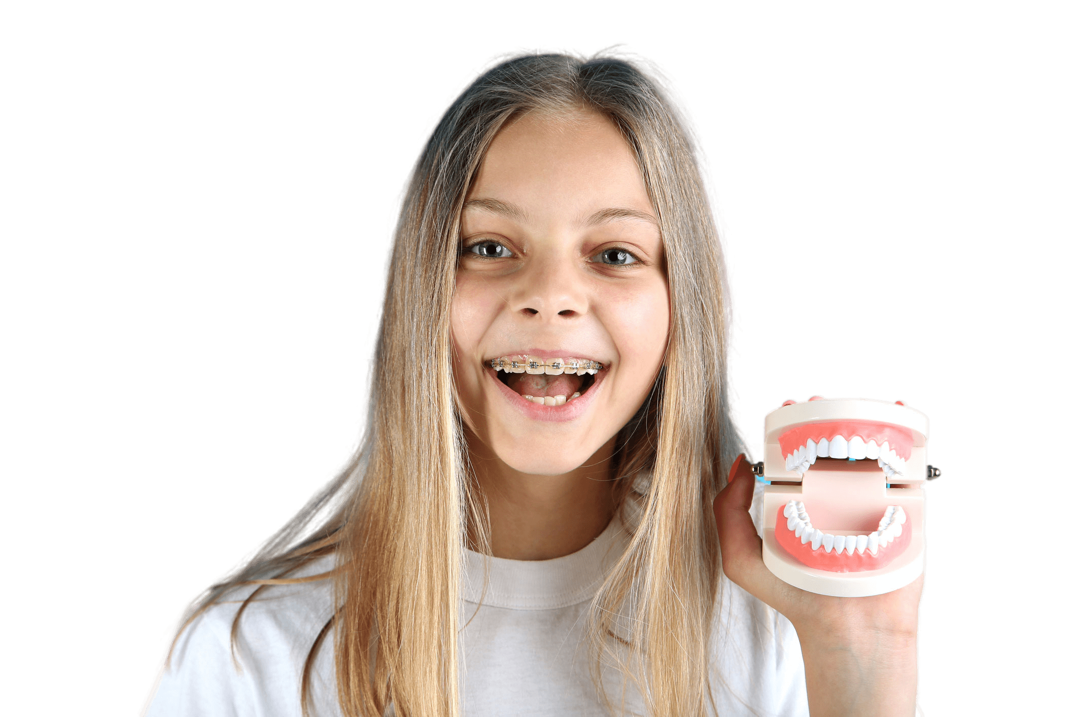 Ортодонтия: брекеты и элайнеры в Новороссийске - New Smile Clinic