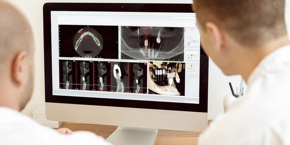 Зубная консультация. Консультация по имплантации зубов. Планирование операции имплантации. Диагностика имплантации. Стоматология технологии.